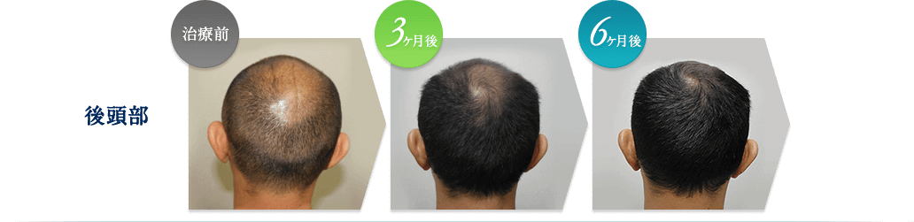 側頭部