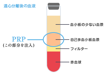 使用する部分